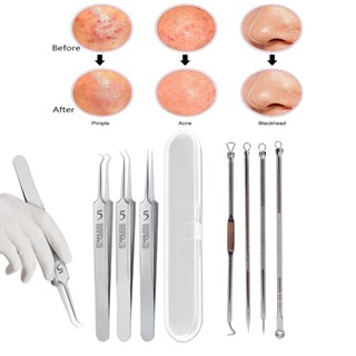 Bộ Dụng Cụ Loại Bỏ Mụn Đầu Đen Siêu Mịn Không. Set 5 Kẹp Nhíp Lấy Mụn Đầu Đen Làm Sạch Sâu Chăm Sóc Da