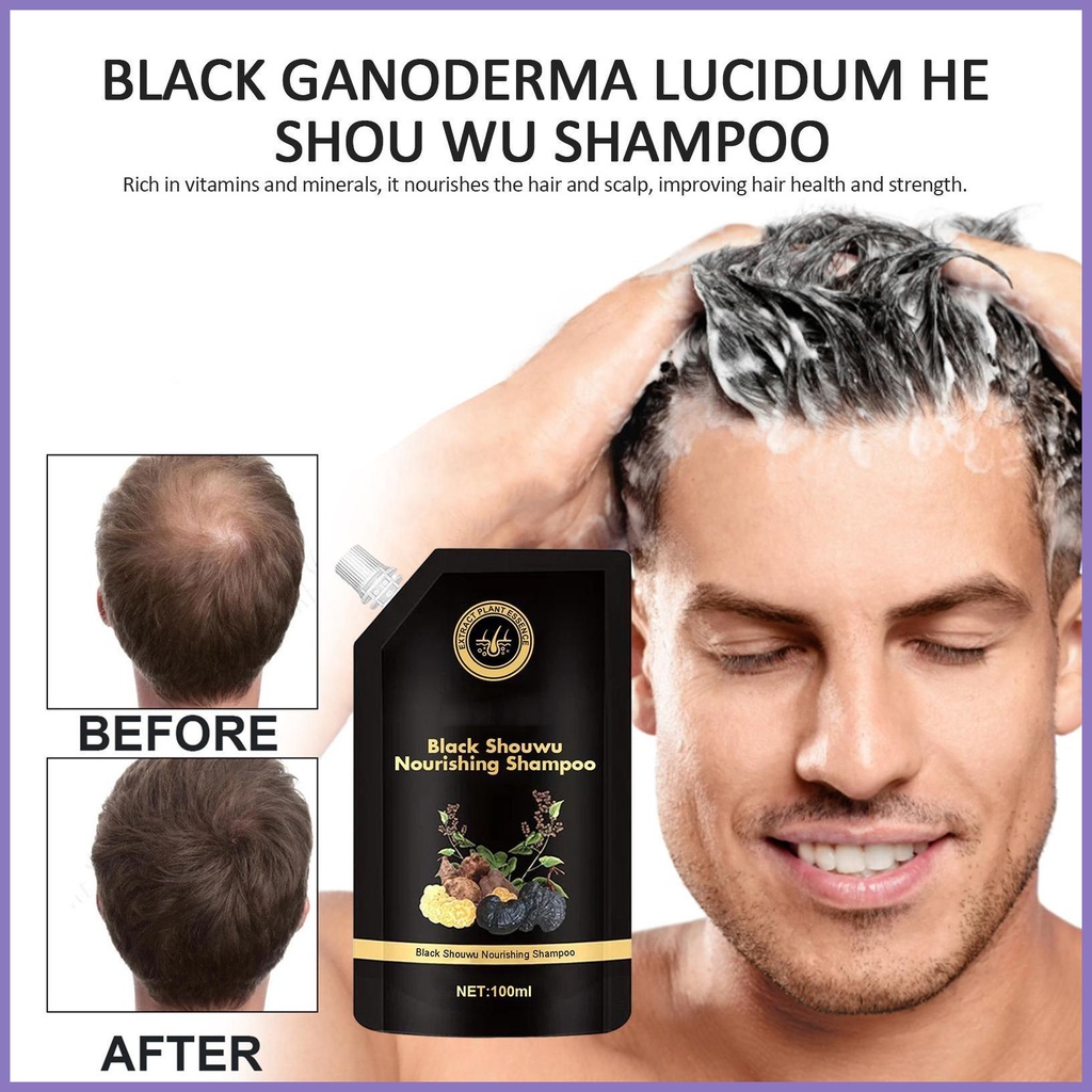 Dầu Gội Làm Tối Màu Tóc Nuôi Dưỡng Công Thức Hói Đầu Cho Nam Dày Dặn nota2vn