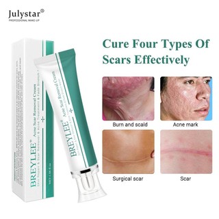 Kem xóa sẹo JULYSTAR 30g hỗ trợ giảm mụn loại bỏ vết rạn làm trắng phục hồi chăm sóc da