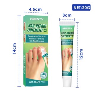 kem phục hồi móng cải thiện hư tổn móng kích thích mọc móng nhanh chóng Cải thiện vết nứt móng tay