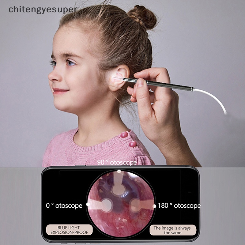 1 Bộ Dụng Cụ Lấy Ráy Tai Thông Minh Quan Sát Ráy Tai