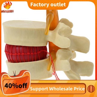 Lumbar vertebrae mô hình cột sống đĩa thắt lưng di sản giải mã hóa diềm xếp nếp