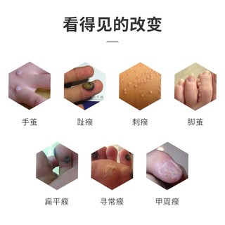 Bán Chạy Nhất#初妮鸦胆子成膜抗菌剂鸡眼老茧肉刺瘊子赘清生物膜身体护理厂家1128n