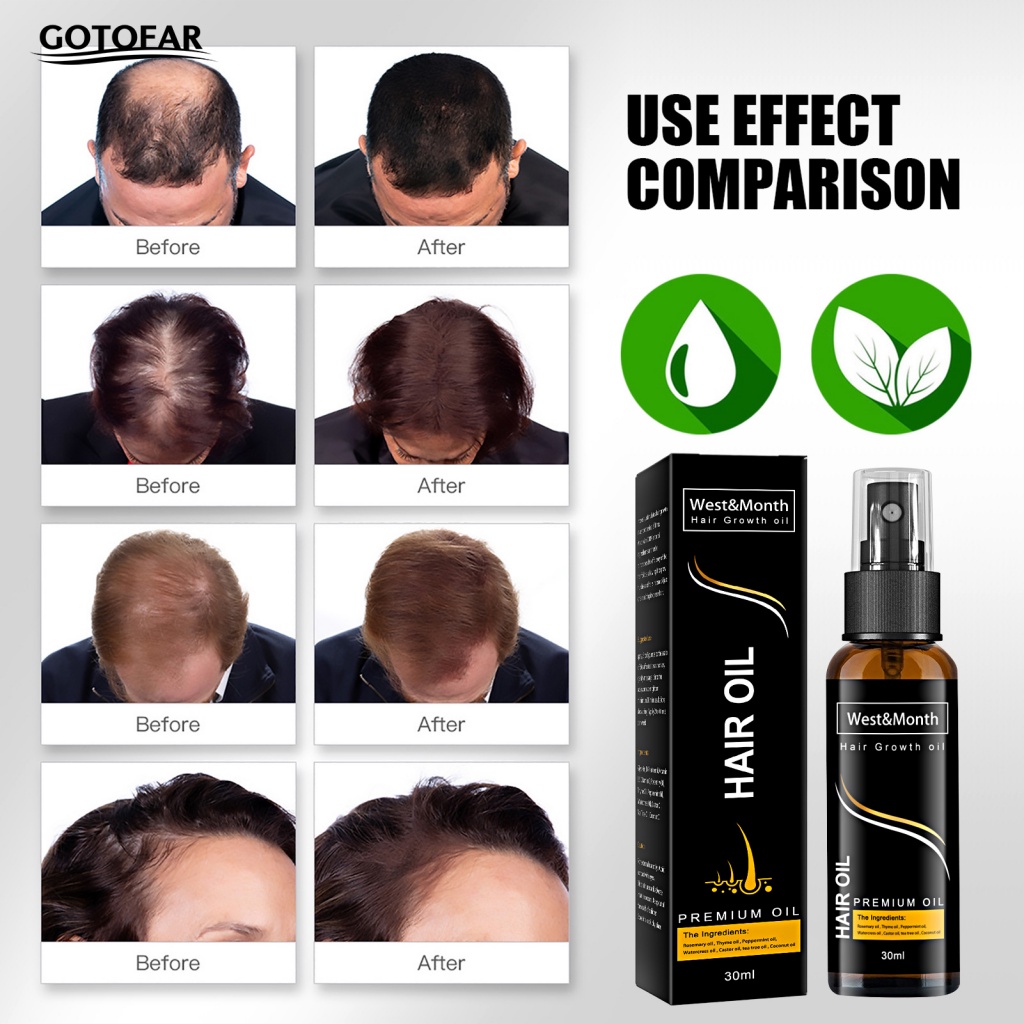 Tinh Dầu Kích Thích Mọc Tóc Tại Nhà 30ml