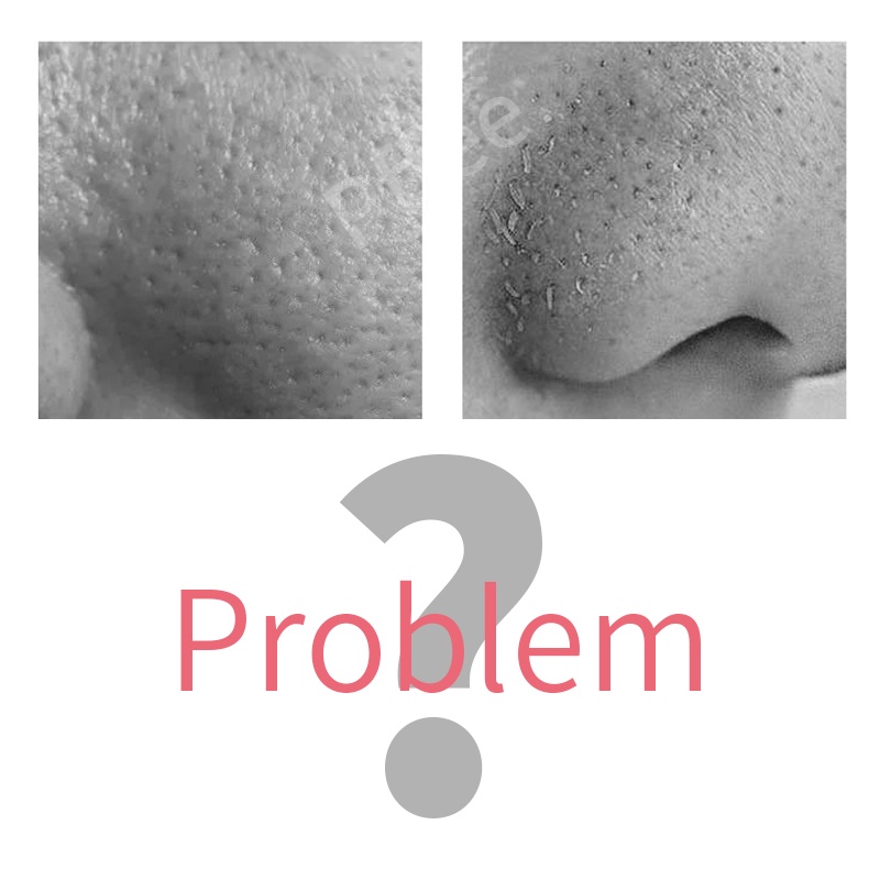 10 Miếng Dán Mũi Lột Mụn Đầu Đen pffee