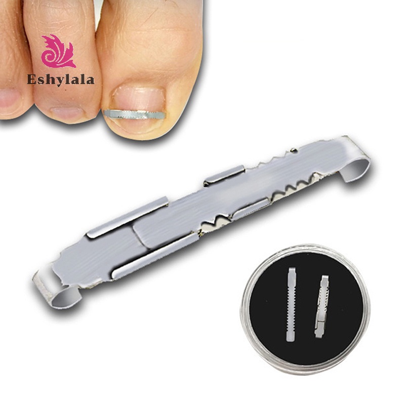 Dụng Cụ Định Hình Móng Chân Cái [Mới]