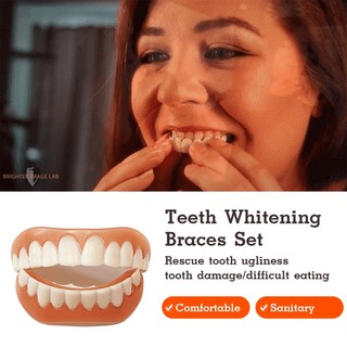 Smile veneers Vòng Đeo Răng Giả Nha Khoa/Vỏ làm trắng răng có thể tháo rời/vỏ làm trắng răng