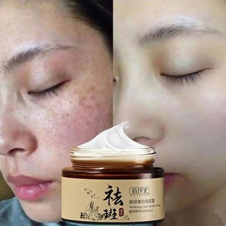 Kem xóa tàn nhang đồi mồi Kem Làm trắng30gLàm mờ thâm ,kem nám tàn nhang đồi mồi