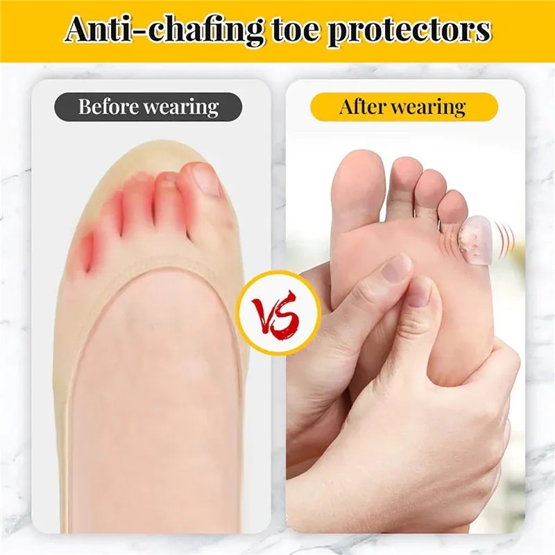 Silicone Set 20 Miếng Silicon Bảo Vệ Ngón Chân Chống Ma Sát Thoáng Khí Cho Nam Nữ