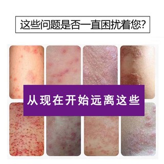 Bán Chạy#严和日本止痒软膏皮肤瘙痒抑菌乳膏草本外用软膏电商快手抖音货源11. 22n