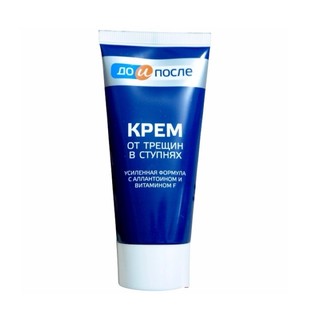 Kem nứt gót chân Nga Kpem