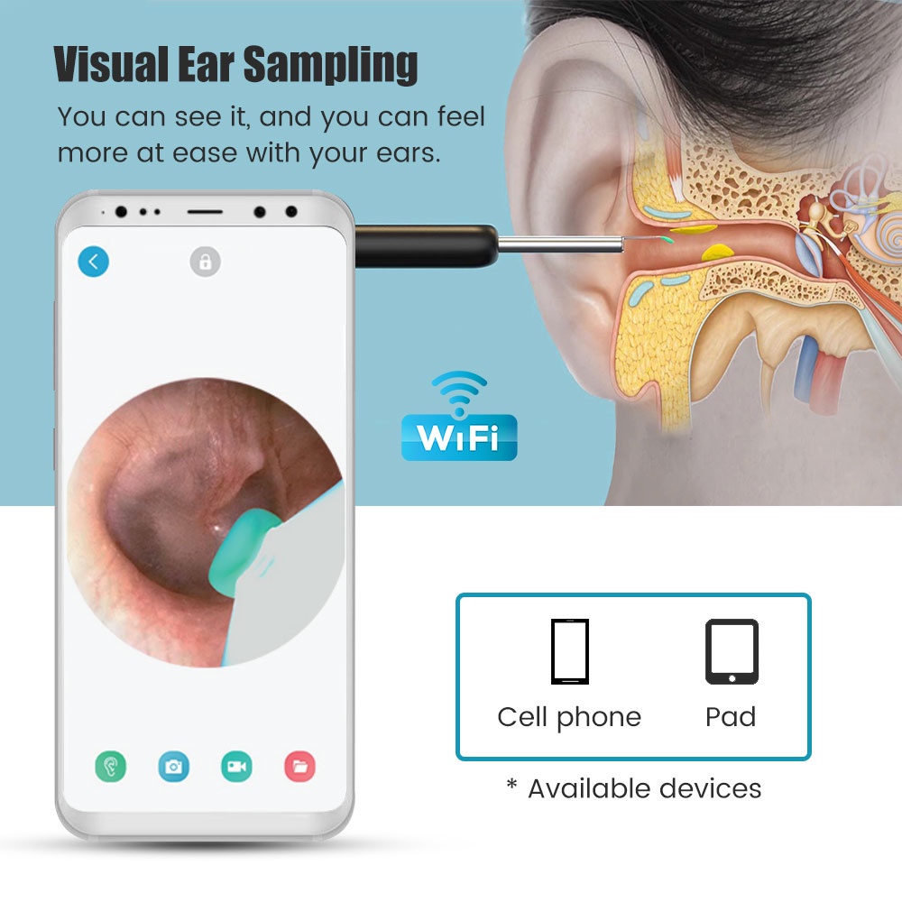 Bộ Dụng Cụ Vệ Sinh Tai Thông Minh Không Dây wi-fi 1080p hd