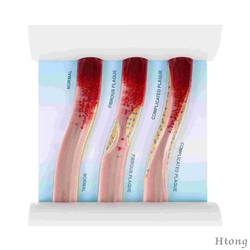 Vesel Mô Hình Bộ Xương Môi Tương Phản lipoprotein cardiovascular dynamic lipid Dùng Dạy Học