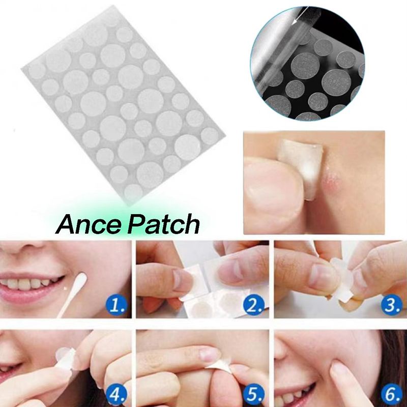 🔮Bộ 36 miếng dán Ngôi sao loại bỏ mụn chăm sóc da chuyên dụng