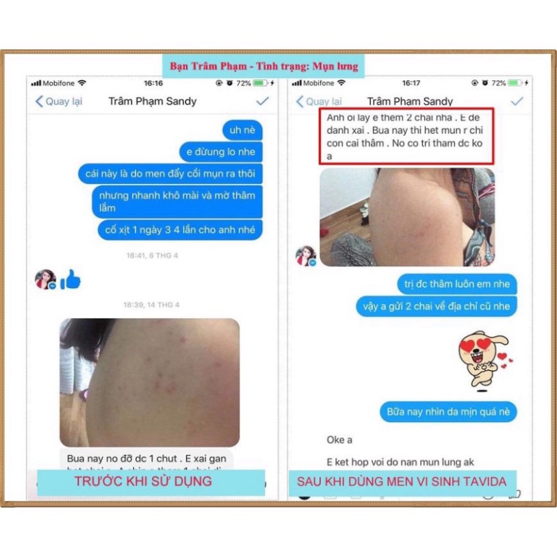 Xịt lợi khuẩn Bio Skin - Men xịt đánh bay mụn lưng, viêm nang lông tư Nhật Bản | BigBuy360 - bigbuy360.vn