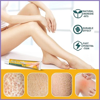 Kem trị nứt da 0.7oz chiết xuất trái cây / vảy cá / da rắn / vảy cá / da rắn / da rắn 0.7oz nota2vn