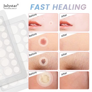Axit 72 Miếng dán trị mụn dạng hạt Miếng dán trị mụn vô hình Mụn in Mụn Miếng dán trị mụn JULYSTAR