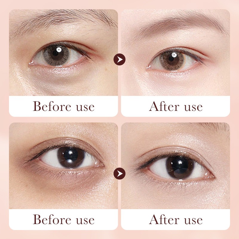 Kem dưỡng chống nhăn  chống lão hóa giảm thâm quầng mắt Sadoer Rentinol Anti - Wrinkle Eye Cream stick S20