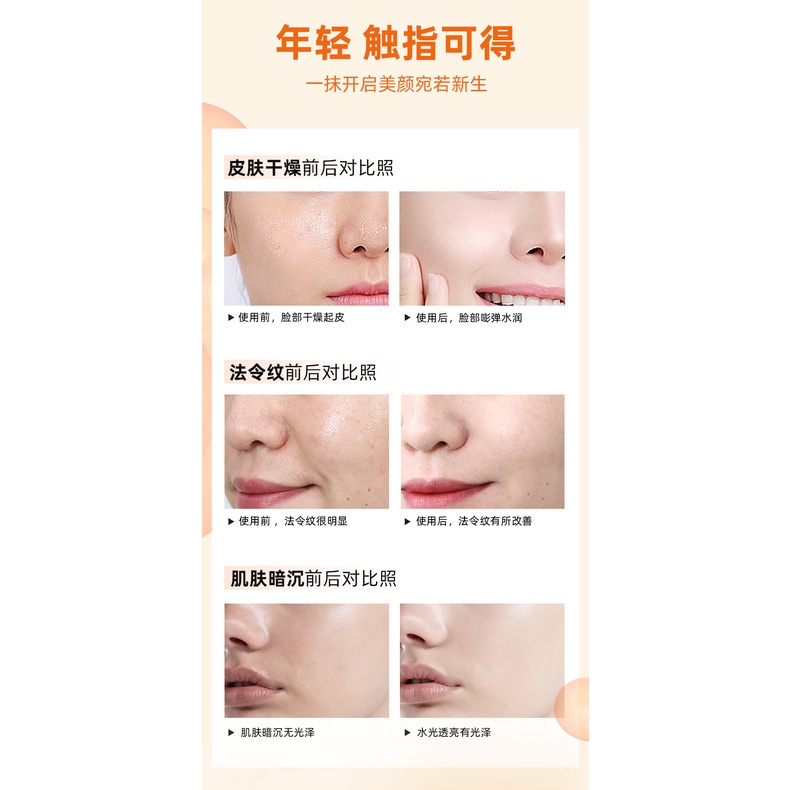 Kem vitamin c Năm Nếp Nhăn Dưỡng Ẩm Làm Săn Chắc Da