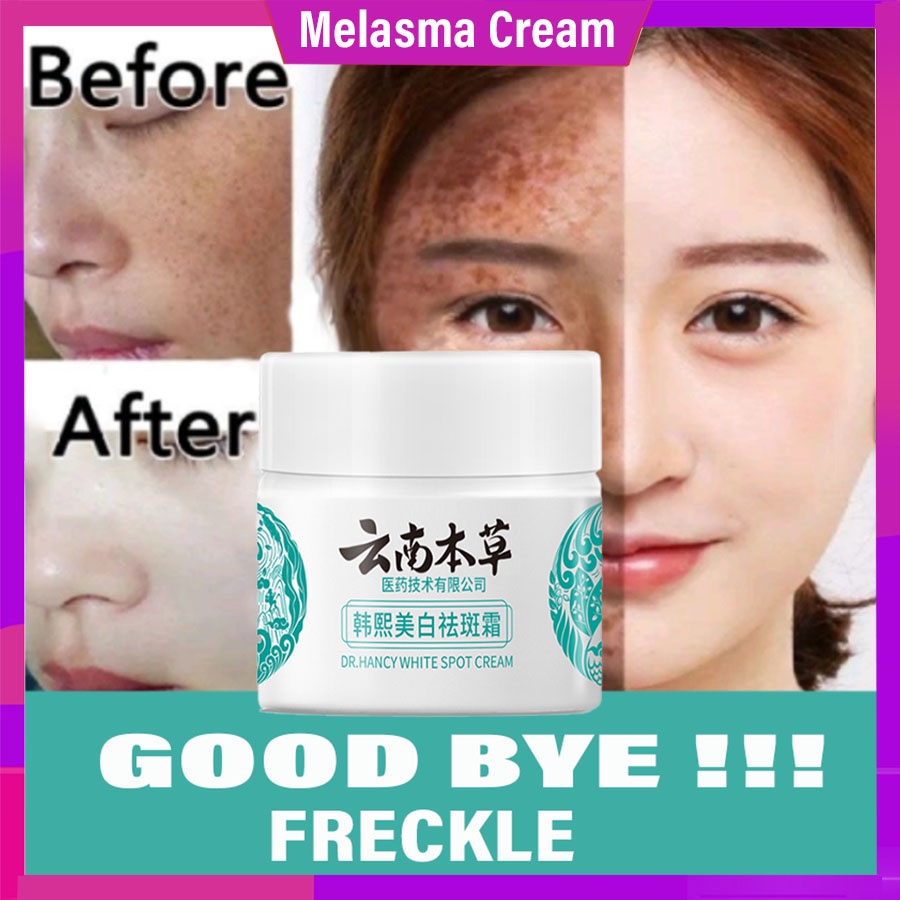 Kem Dưỡng Trắng Da Mặt Nunnan herbal Giữ Ẩm Chống Tàn Nhang Hiệu Quả