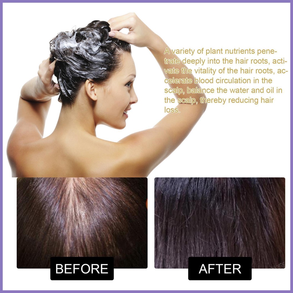 Dầu Gội Làm Tối Màu Tóc Nuôi Dưỡng Công Thức Hói Đầu Cho Nam Dày Dặn nota2vn