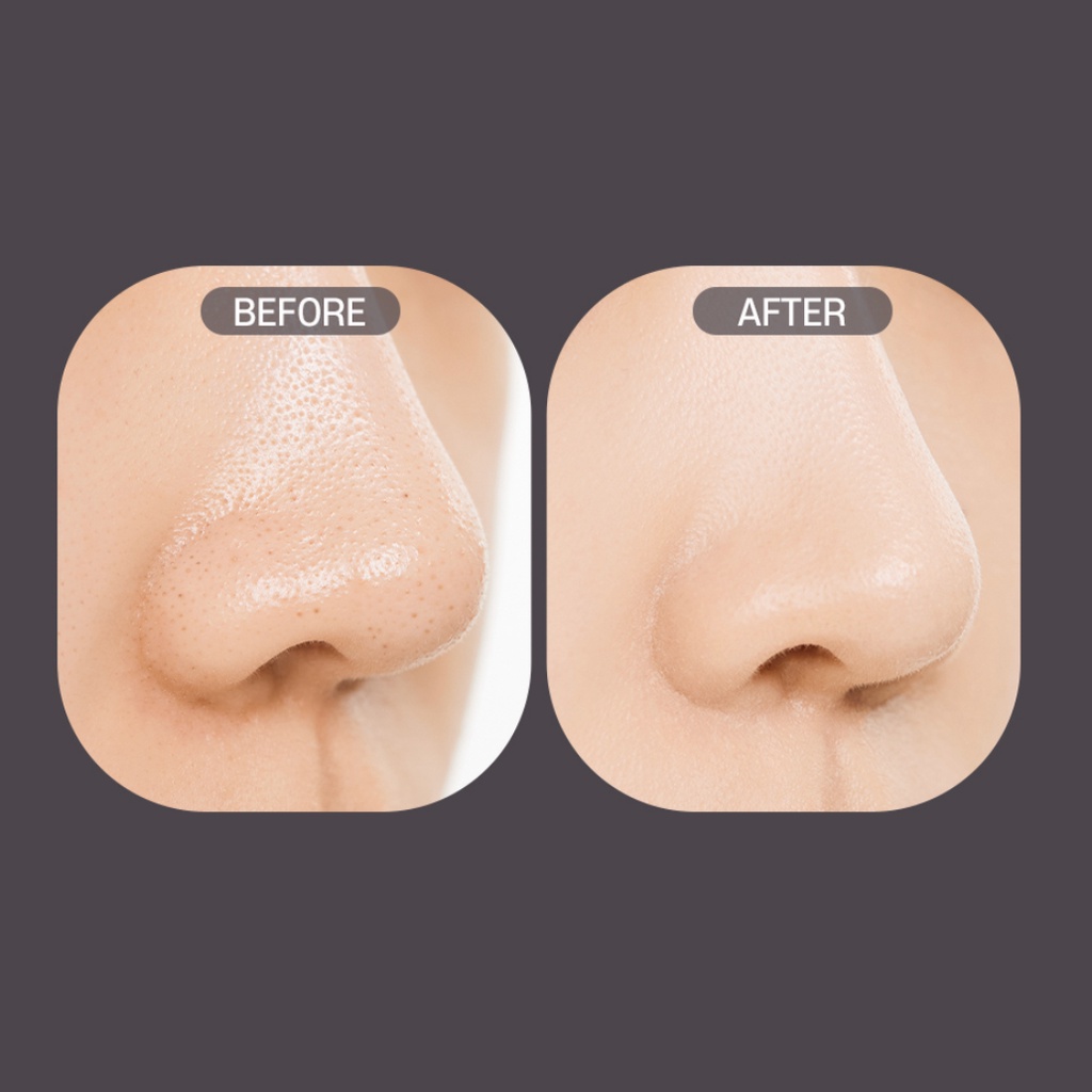 Nature Republic Black Charcoal Pore Toner Pad 100g