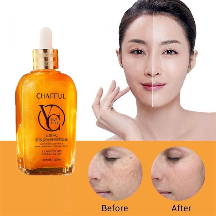 Serum Vitamin C 100ml Chống Lão Hóa Dưỡng Ẩm Làm Sáng Da