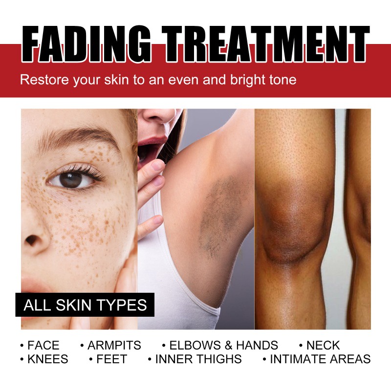 Kem Dưỡng Ẩm Kasys Làm Trắng Da Xóa Mờ Vết Thâm Và Tàn Nhang