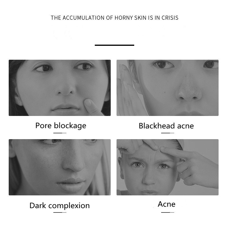 Aloe gel Tẩy Tế Bào Chết Làm Sạch Sâu Loại Bỏ Mụn Trứng Cá Tẩy Tế Bào Chết 60g