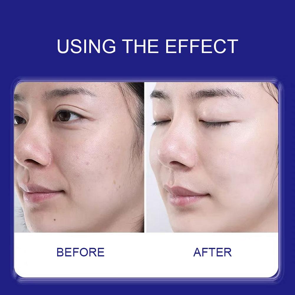 Kem Xóa Nếp Nhăn Chống Lão Hóa Nâng Cơ Mặt p4y2