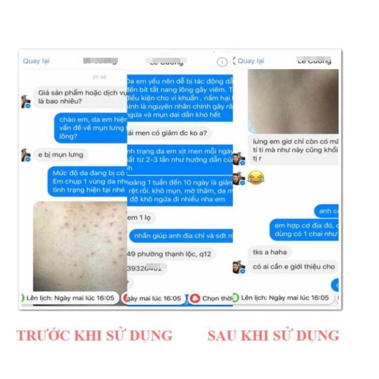 Xịt lợi khuẩn Bio Skin - Men xịt đánh bay mụn lưng, viêm nang lông tư Nhật Bản | BigBuy360 - bigbuy360.vn