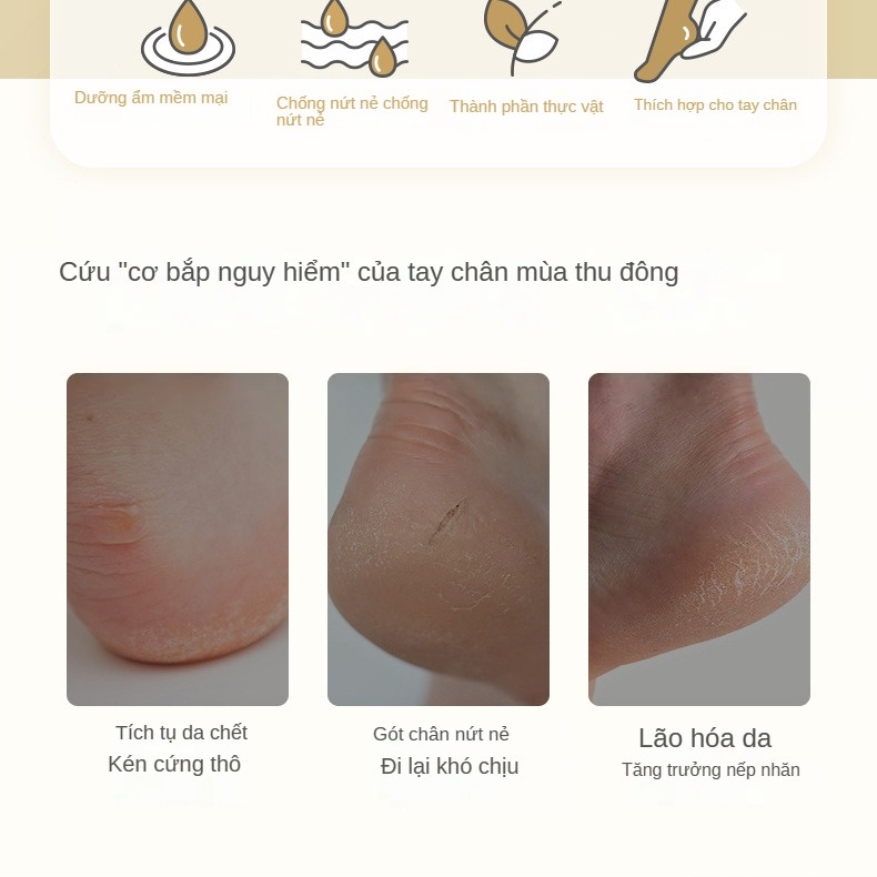 Kem Dưỡng Ẩm Chống Khô Da Tay Và Chân Vào Mùa Đông