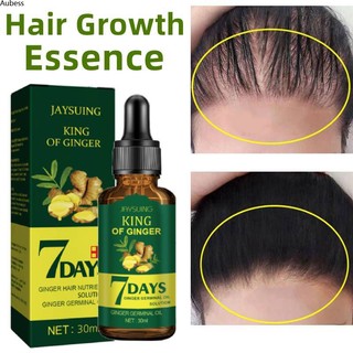 Serum tóc mọc tóc nhanh dài điều trị rụng tóc minoxidil dầu tinh chất mọc tóc thúc đẩy mọc tóc 30ml aubessds