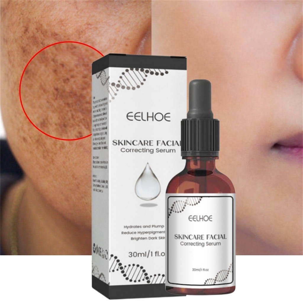 Vog Retinol Dark Spot Remover Face Serum Làm trắng da Chăm sóc da Loại bỏ tàn nhang Sắc tố Làm sáng Collagen Hyaluronic Acid Facial Serum