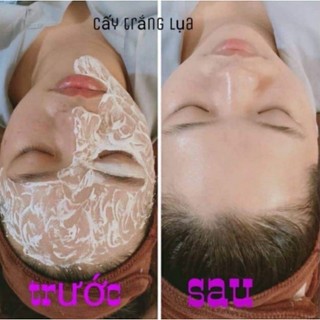 CẤY TRẮNG LỤA NANO HOÀNG GIA DÀNH CHO SPA