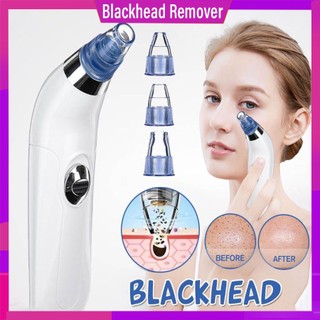 Máy Hút Mụn Đầu Đen Làm Sạch Lỗ Chân Lông Đa Năng