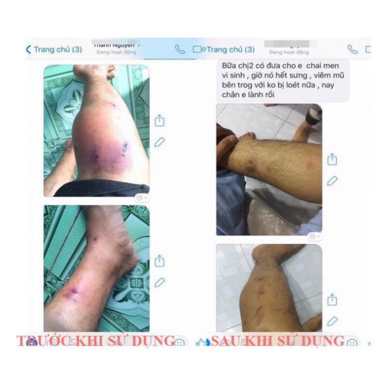 Xịt lợi khuẩn Bio Skin - Men xịt đánh bay mụn lưng, viêm nang lông tư Nhật Bản | BigBuy360 - bigbuy360.vn