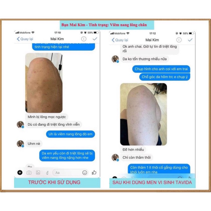 Xịt lợi khuẩn Bio Skin - Men xịt đánh bay mụn lưng, viêm nang lông tư Nhật Bản | BigBuy360 - bigbuy360.vn