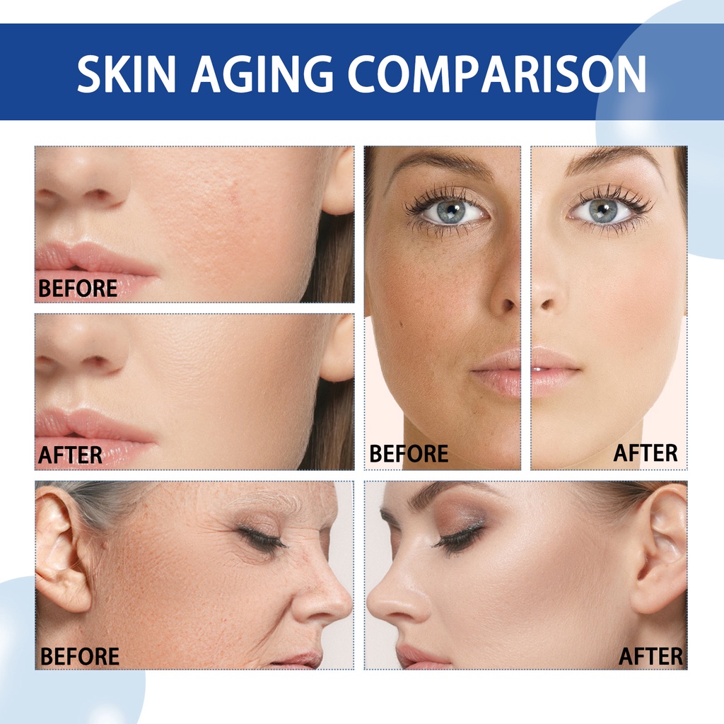 Serum b3 5% niacinamida Dưỡng Ẩm Chống Nếp Nhăn Lão Hóa Làm Sáng Da Mặt