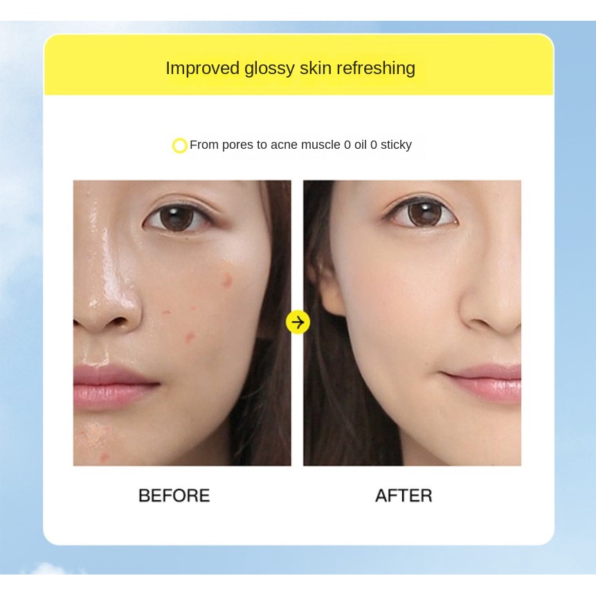 Krasys Tinh Chất Tự Nhiên Nuacinamide Tái Tạo Da Dưỡng Ẩm Kiềm Dầu Se Khít Lỗ Chân Lông