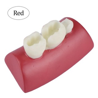 Mô Hình Hàm Răng Tập Luyện Bằng Nhựa resin