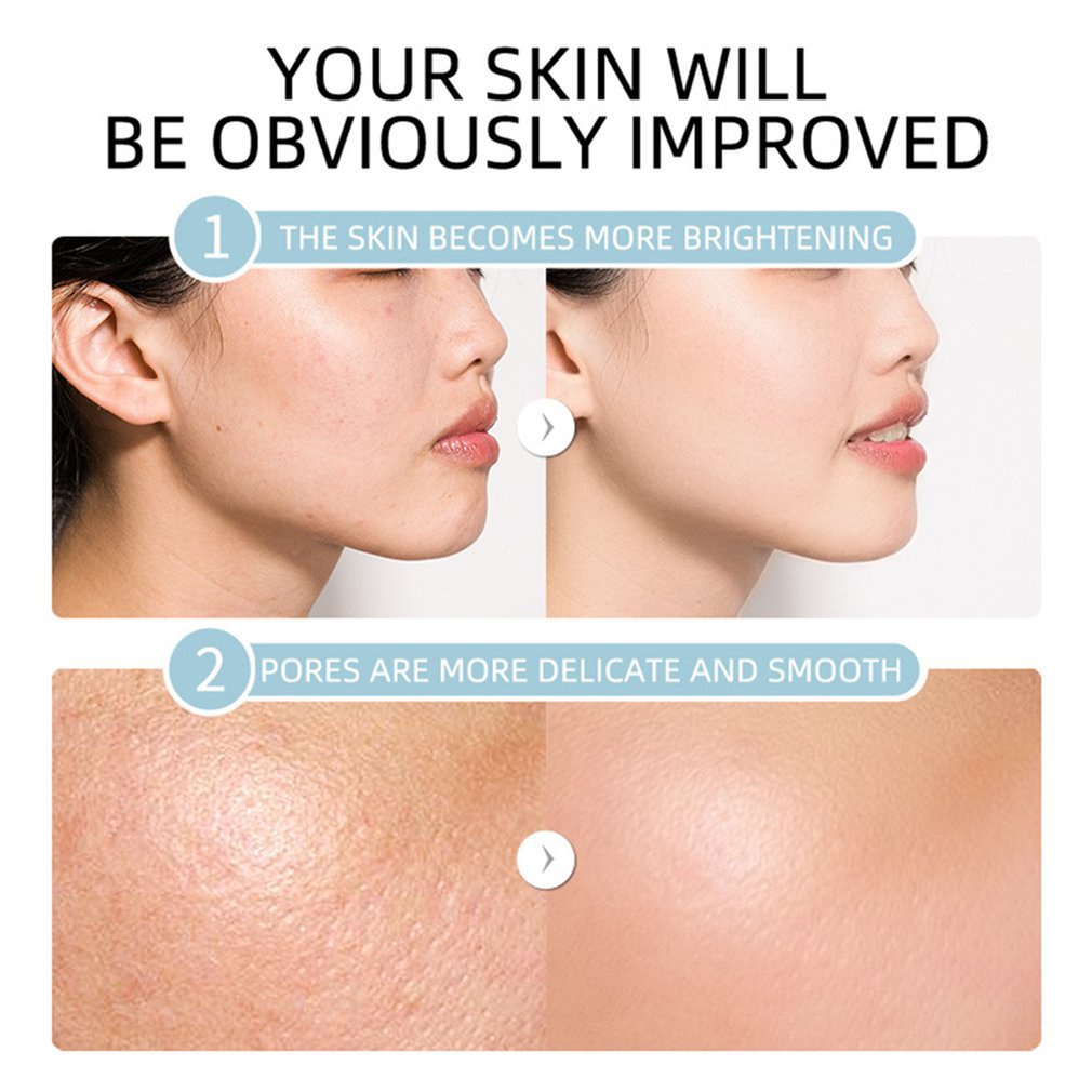 Serum Dưỡng Ẩm Tự Nhiên Làm Sáng Da Kiểm Soát Dầu