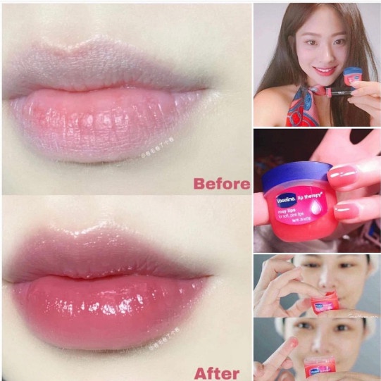 Sáp Dưỡng Môi Mềm Mịn Vaseline 7g Lip Therapy