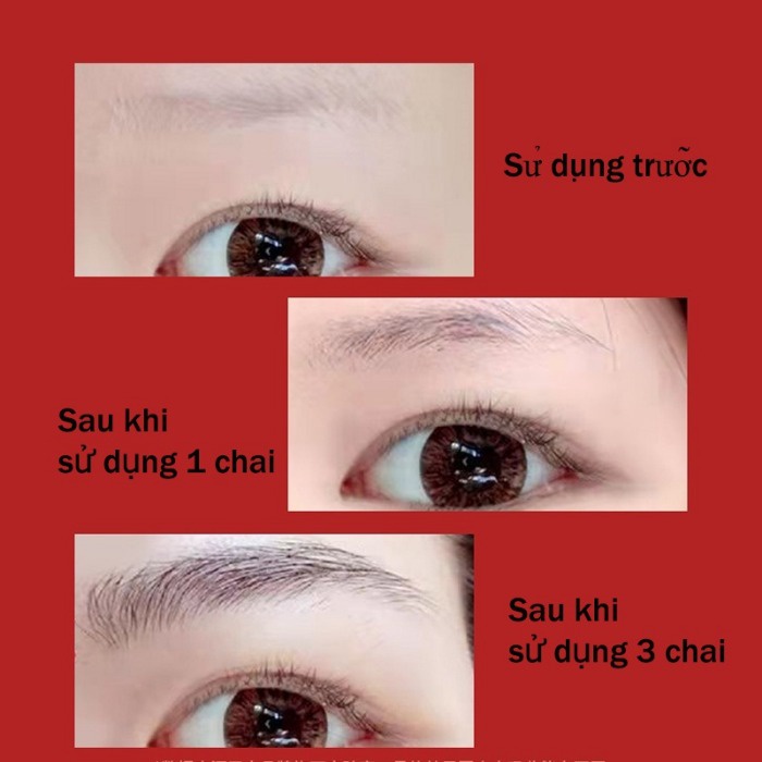 Serum mọc lông mày tinh chất kích mọc lông mày, lông mi,lông râu,mọc tóc,thúc đẩy lông mày dày và dài