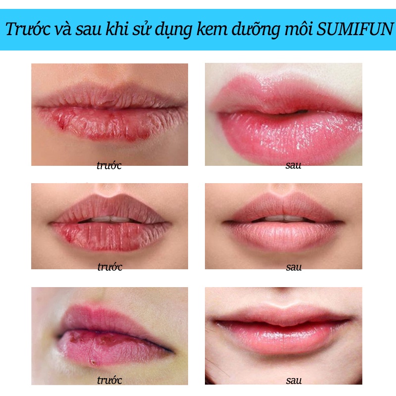 Kem Dưỡng Môi SUMIFUN Cheilitis Cream 20g, Giúp Dưỡng Ẩm Cho Môi, Cải Thiện Tình Trạng Khô, Nứt Nẻ, Giảm Thâm Sạm Môi ICE