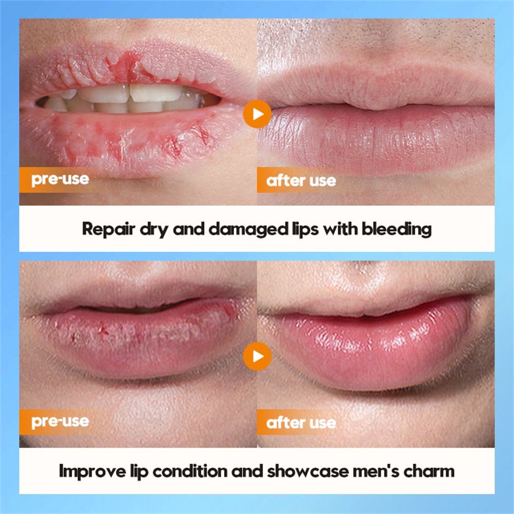 Son môi Vaseline cho nam Angle Cá chép Thu Đông Cải thiện Son môi khô JULYSTAR