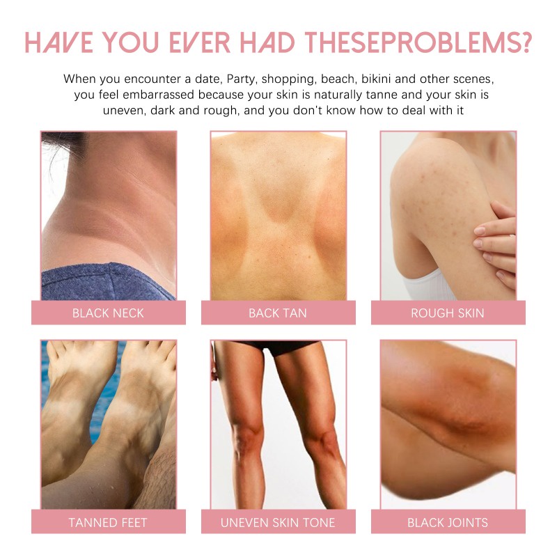 Kem Dưỡng Trắng Da Toàn Thân Kasys Làm Mờ Đốt Đen Dưỡng Ẩm