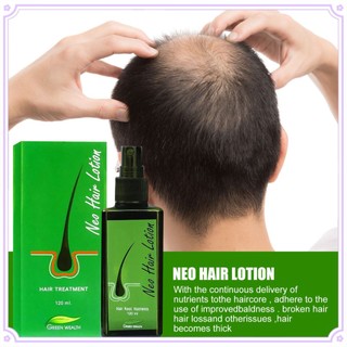 Chai xịt kích thích mọc tóc chống rụng tóc hiệu quả