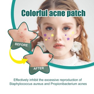 Set 40 / 36 Miếng Dán Mụn Hydrocolloid Chăm Sóc Da