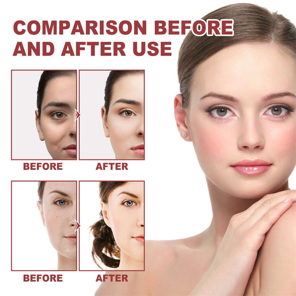 Mặt nạ hòa tan trong nước màng collagen giàu protein làm mờ quầng thâm dưới bọng mắt Mặt nạ dưới mắt Nhẹ nhàng làm săn chắc nếp nhăn JULYSTAR